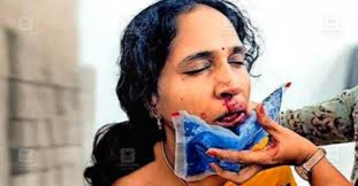 ക്ലാസില്‍ ഗെയിം കളിച്ചത് ചോദ്യംചെയ്‌തു;വിദ്യാർത്ഥിയുടെ ആക്രമണത്തില്‍ മലയാളി അദ്ധ്യാപികയ്‌ക്ക് ഗുരുതര പരിക്ക്